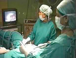 A doctor using a laparoscope