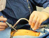 A laparoscope