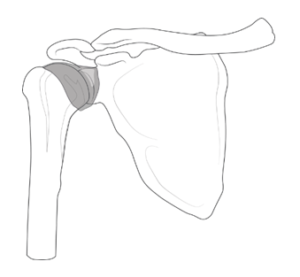 Thickened Shoulder capsule