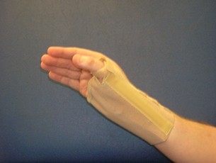 thumb splint that limits wrist movement