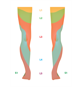 legs showing areas of pain