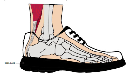 foot in a shoe