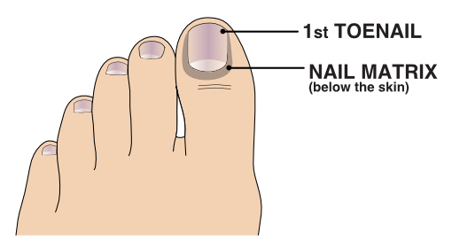Illustration of the nail matrix of the toe