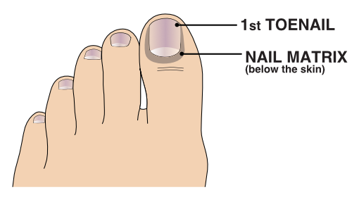 Nail Surgery | NHS Lanarkshire