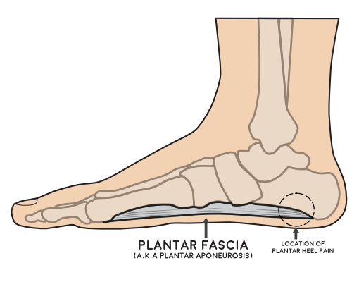 Foot with location of plantar fascia location