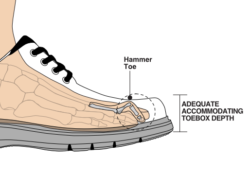 Illustration of good shoe toebox depth