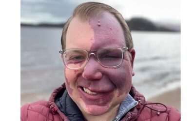 Face Equality Week 2022
