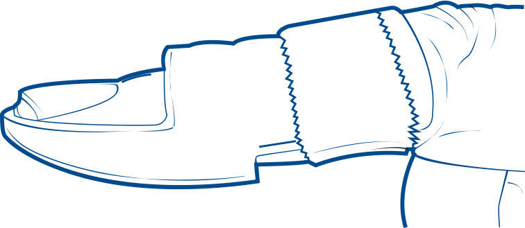 Illustration of an index finger in a splint, from a side profile.