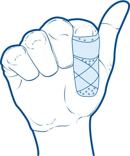Illustration of an index finger in a splint.