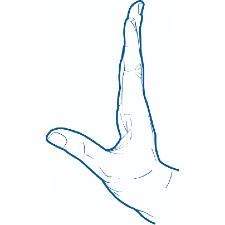 Exercise for the hand for recovering from a 5th metacarpal fracture