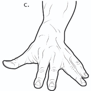 Exercise for finger after an injury