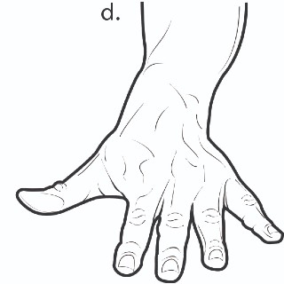 Exercise for finger after an injury