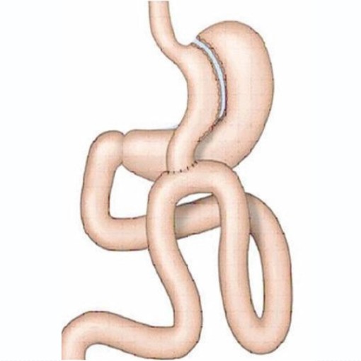 Diagram of the stomach