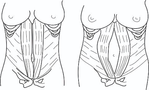 Diagram of the abdominal muscles