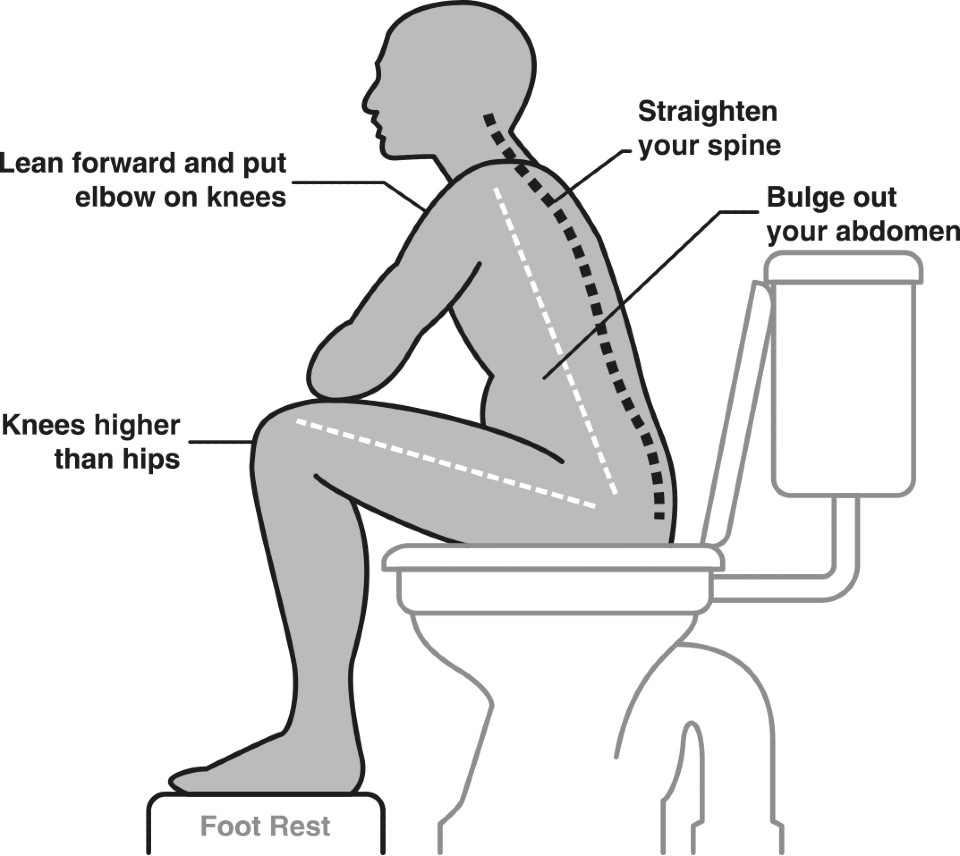 Diagram of sitting on the toilet with proper posture to relieve constipation