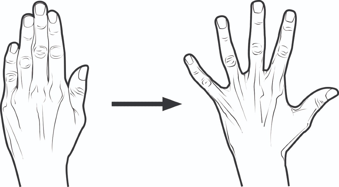 Exercise for finger after an injury