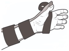 Diagram of exercises for flexor tendon injuries to the thumb