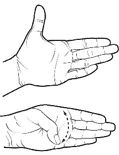 thumb extending across palm