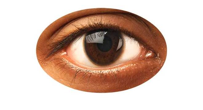 eye an eye