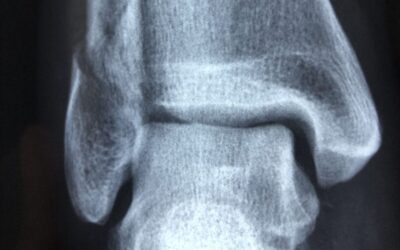 Mobile X-Ray Service: Care Homes – what you need to know