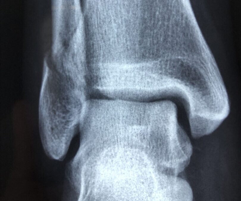 Mobile X-Ray Service: Care Homes – what you need to know